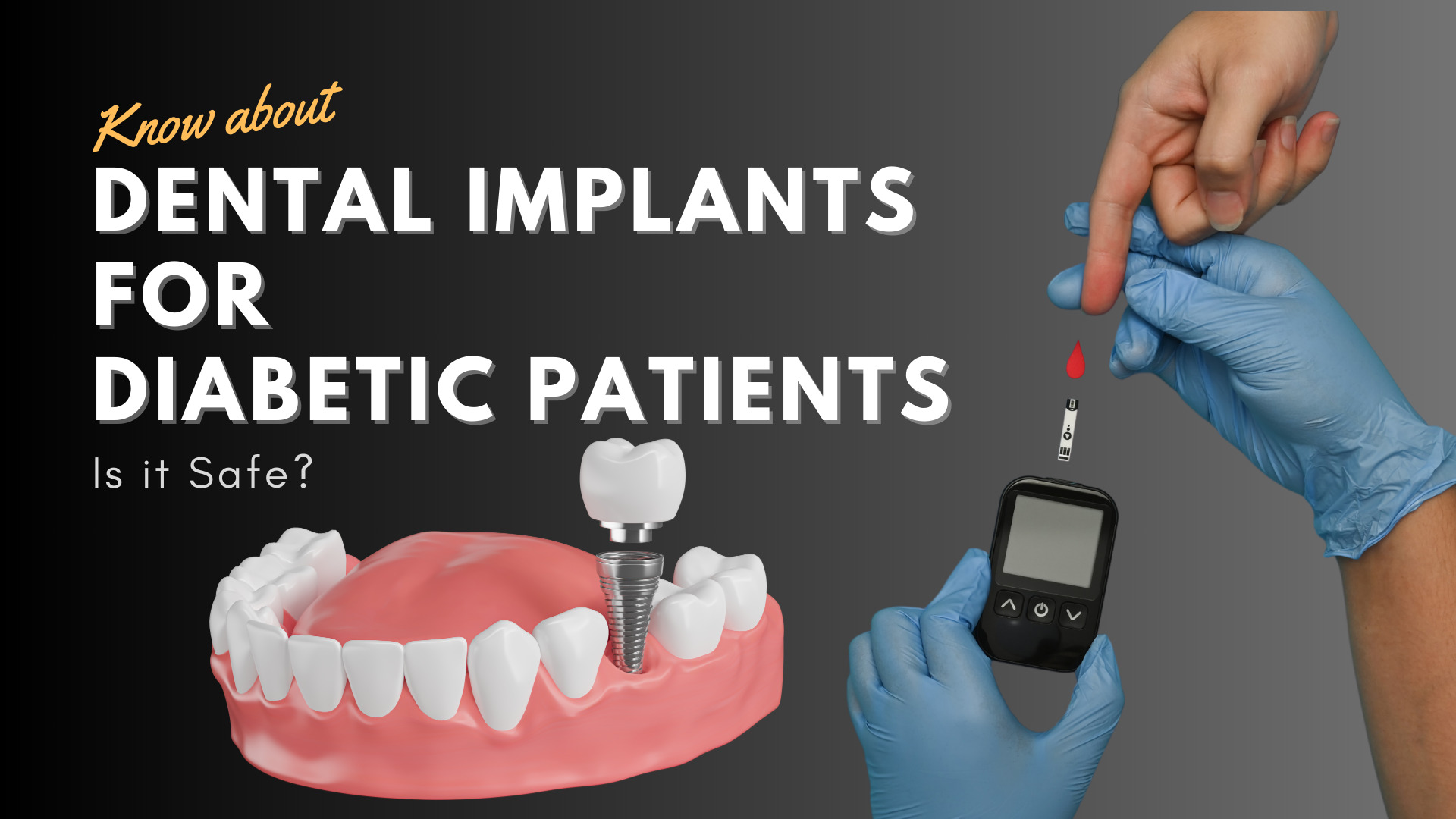 Is dental implant safe for diabetic patients