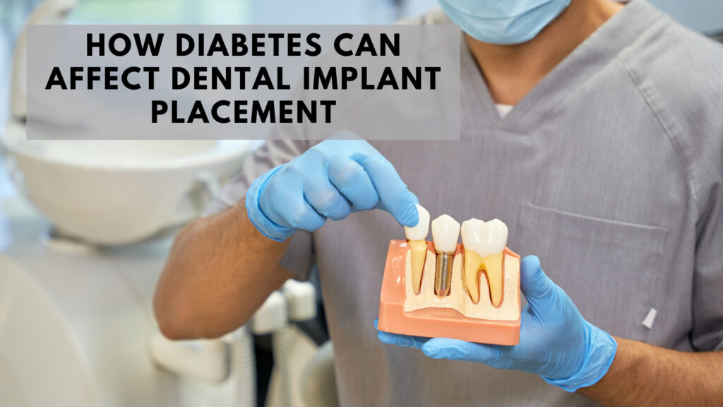 how diabetes can affect dental implant placement