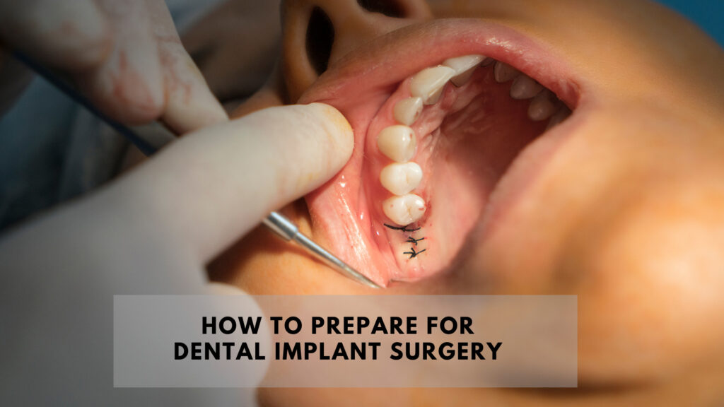 How to prepare for dental implant surgery